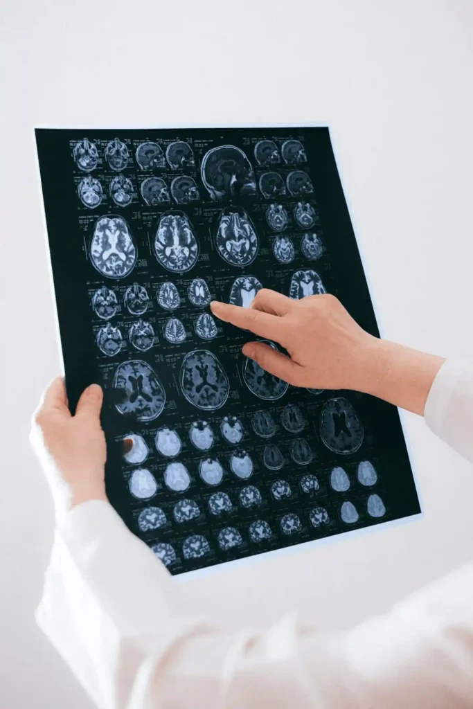 Doctor examining brain MRI scan sheets for head injury diagnosis